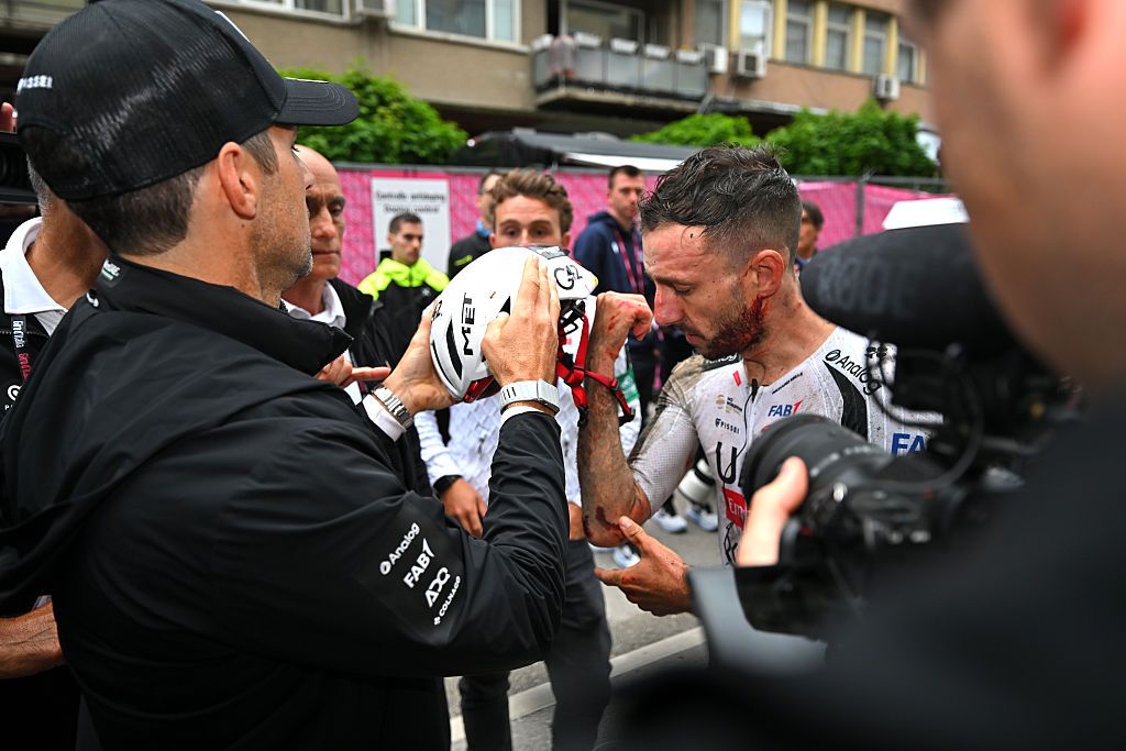 VELIKO TARNOVO, BULGARIA - MAY 09: (EDITORS NOTE: Image depicts graphic content.) Adam Yates of Great Britain and UAE Team Emirates - XRG injured after the 109th Giro d'Italia 2026, Stage 2 a 221km stage from Burgas to Veliko Tarnovo / #UCIWT / on May 09, 2026 in Veliko Tarnovo, Bulgaria. (Photo by Tim de Waele/Getty Images)