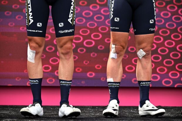 NAPLES ITALY MAY 11 LR Legs detail view of Christian Scaroni of Italy and Mark Cavendish of The United Kingdom and Astana Qazaqstan Team prior to the 106th Giro dItalia 2023 Stage 6 a 162km stage from Naples to Naples UCIWT on May 11 2023 in Naples Italy Photo by Stuart FranklinGetty Images